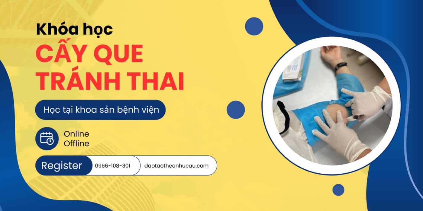 Khóa học cấy que tránh thai