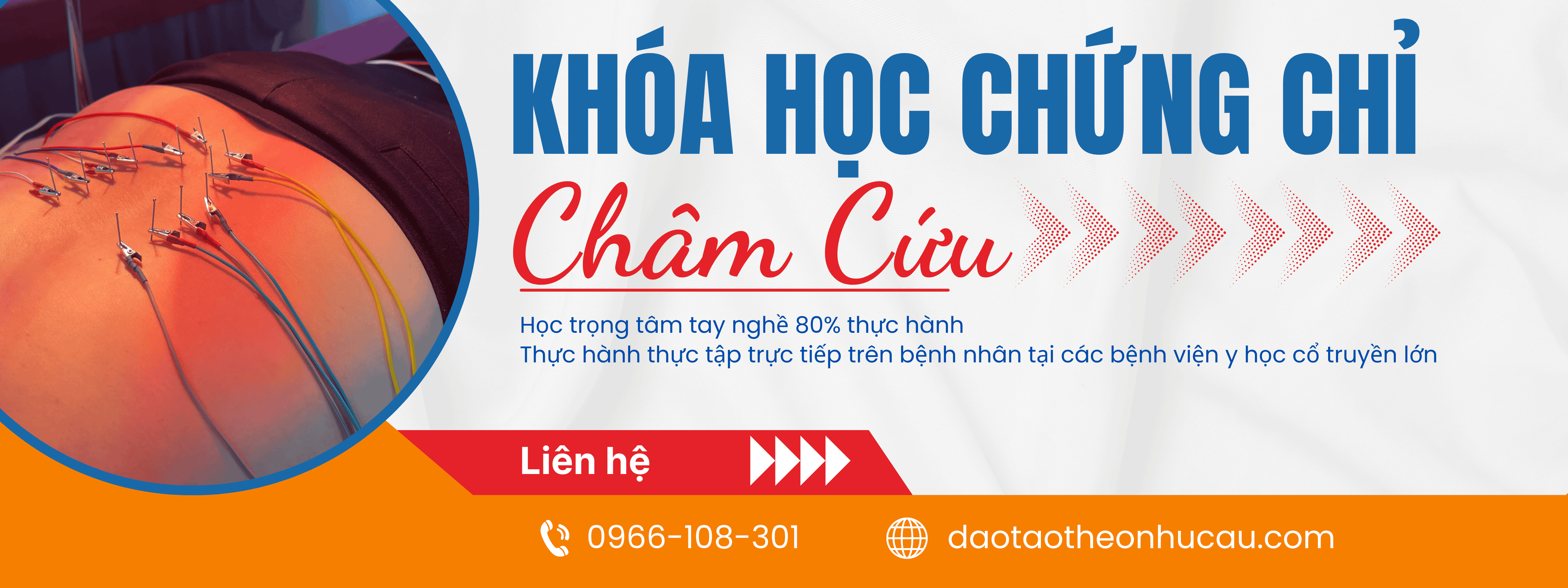 Khóa học chứng chỉ châm cứu